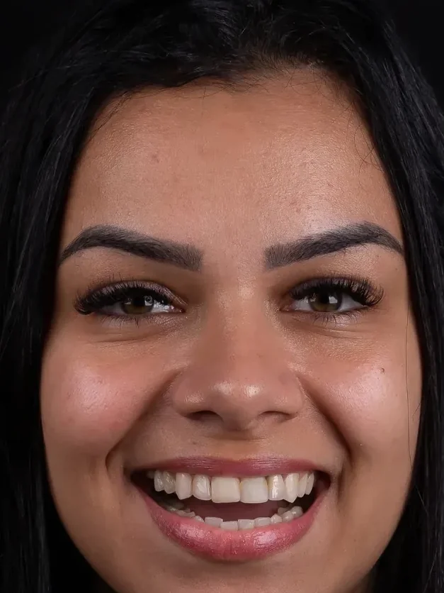 Sorriso antes do tratamento.