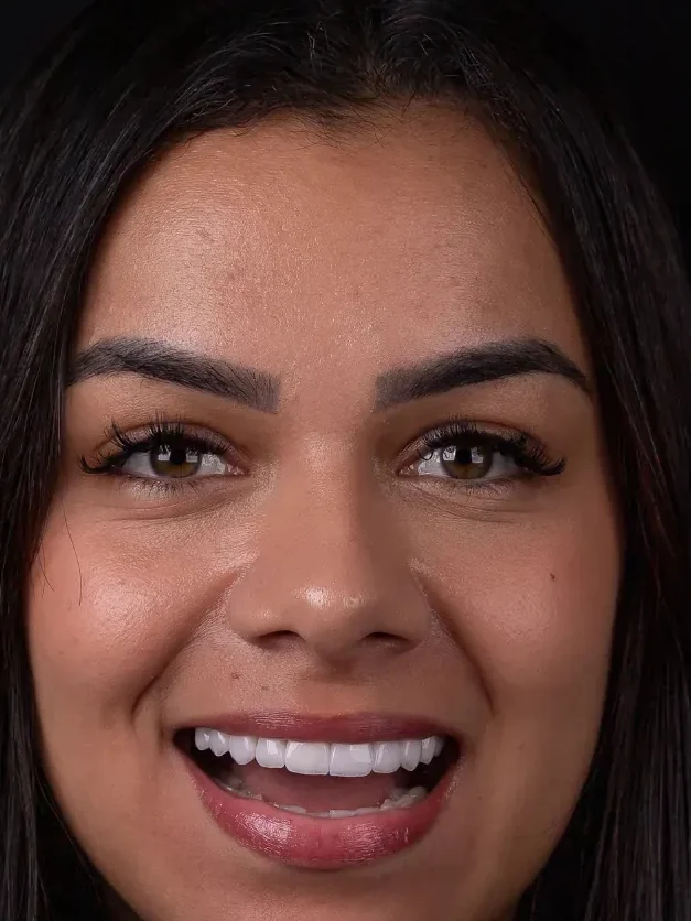 O mesmo sorriso depois do tratamento.